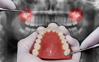 Oral & Maxiliofacial Surgery