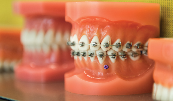 Orthodontics